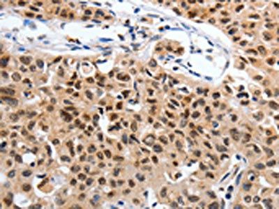 SUMO1 antibody