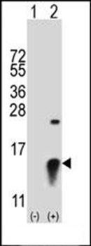 SUMO2 antibody