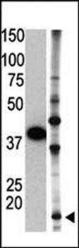 SUMO2 antibody