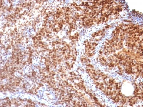 SUMO2 antibody