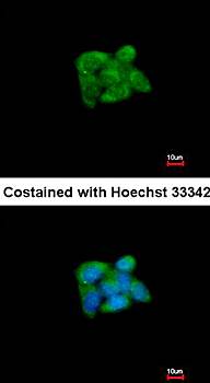 SUOX antibody