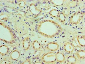 Suppressor of cytokine signaling 1 antibody