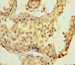 SUPT16H Antibody