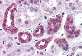 Goat anti-FACT / SUPT16H Antibody