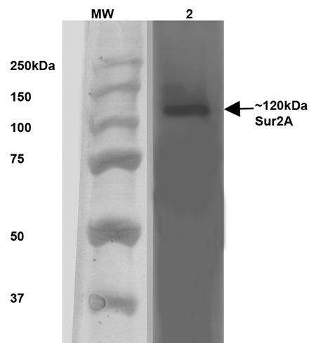 SUR2A Antibody