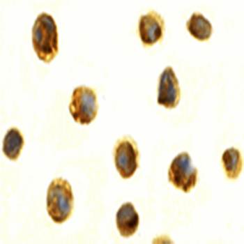 Survivin Antibody