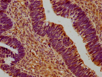 SUSD5 Antibody