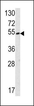 SUV4-20H2 antibody