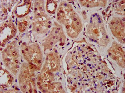 SUZ12 Antibody
