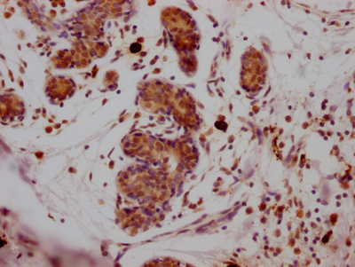 SUZ12 Recombinant Monoclonal Antibody