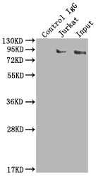 SUZ12 Recombinant Monoclonal Antibody