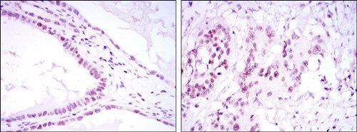 SUZ12 Antibody