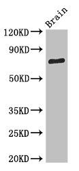 SV2B Antibody