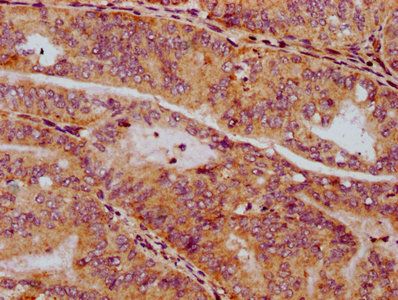 SV2C Antibody