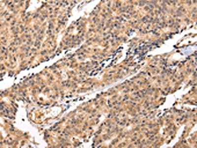 SWAP70 Antibody