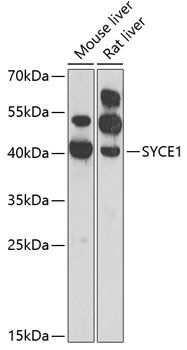 SYCE1 antibody