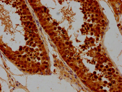 SYCE3 Antibody