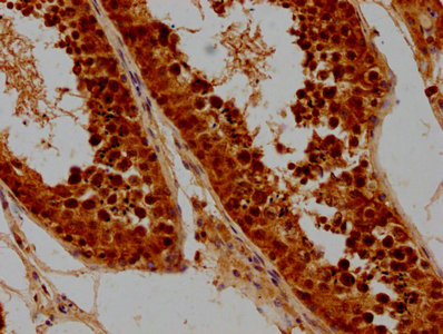 SYCE3 antibody