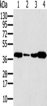 SYCP3 Antibody