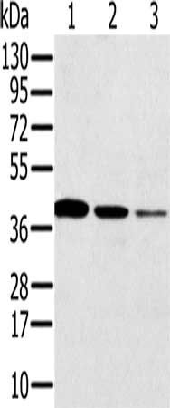 SYCP3 antibody