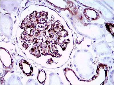 SYCP3 Antibody