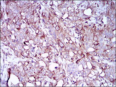 SYCP3 Antibody