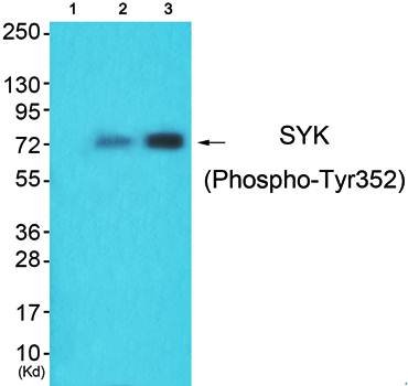 SYK (phospho-Tyr352) antibody