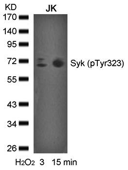 syk (phospho-Tyr323) Antibody