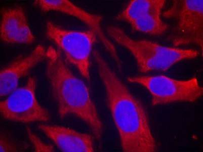 synapsin (Phospho-Ser9) Antibody
