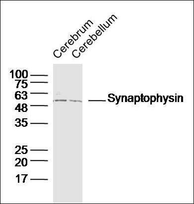 Synaptophysin antibody