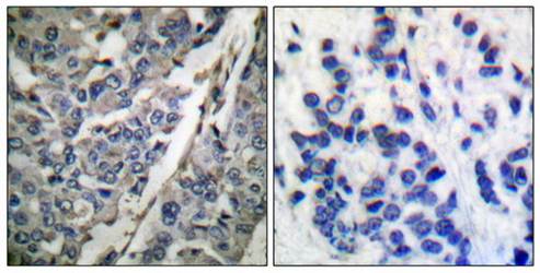 Synaptotagmin (phospho-Thr202) antibody