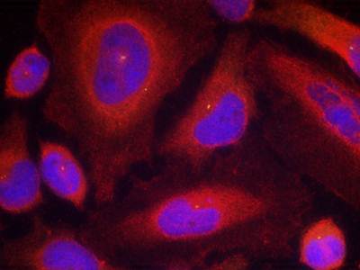 Synaptotagmin 1 (Phospho-Ser309) Antibody