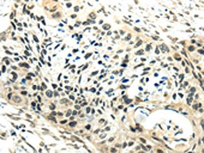 SYNCRIP Antibody
