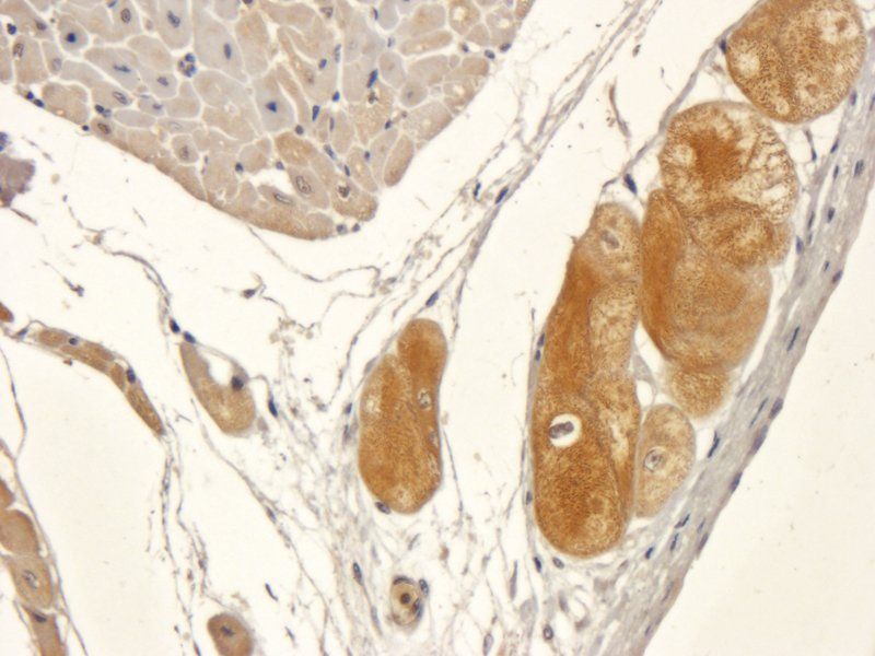 Syncytin 1 antibody