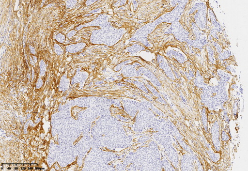 Syndecan 1 Antibody