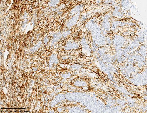 Syndecan 1 Antibody