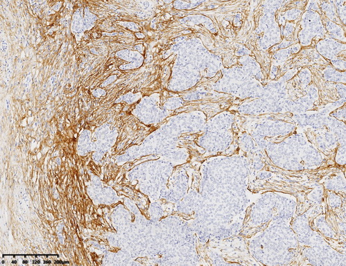 Syndecan 1 Antibody