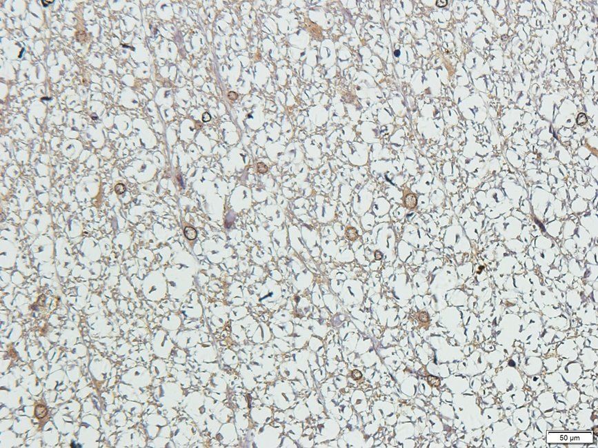 Syndecan 2 antibody