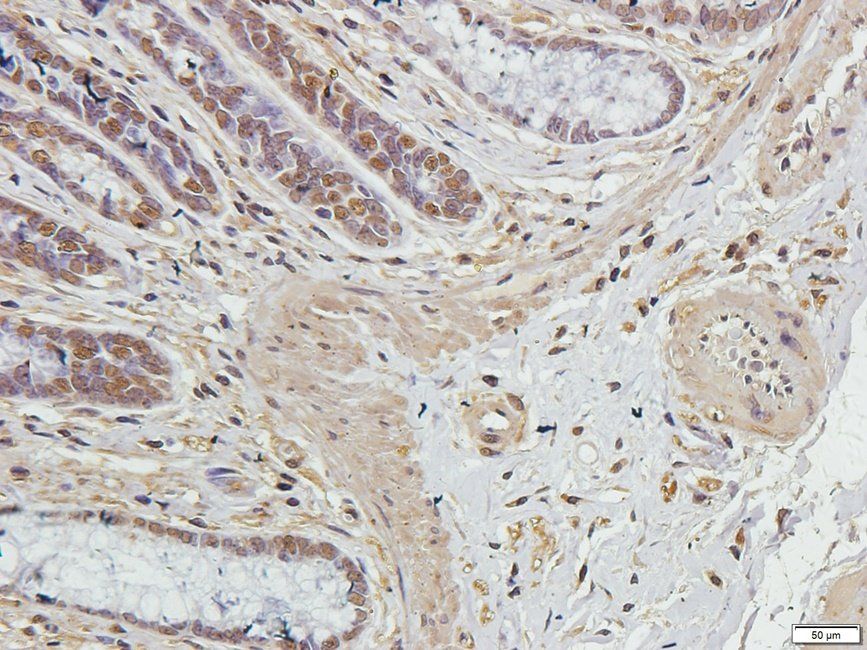 Syndecan 2 antibody