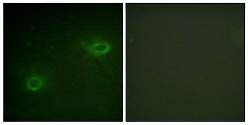 Syndecan4 (Ab-179) Antibody