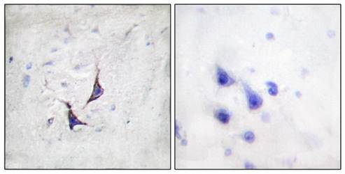 Syndecan4 antibody