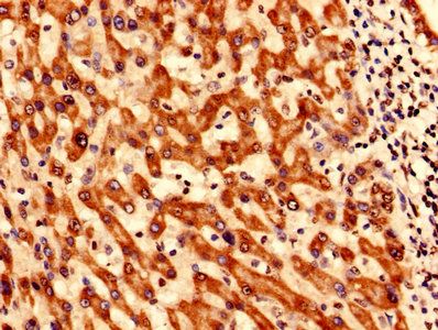 SYNJ2BP Antibody