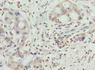 SYNJ2BP Antibody