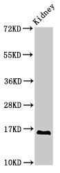 SYNJ2BP Antibody