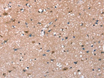SYNPO Antibody