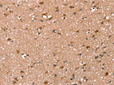 SYNPO2 Antibody
