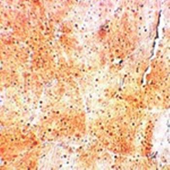 SYNPO2 Antibody