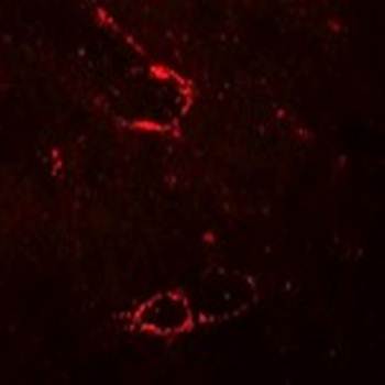 SYNPO2L Antibody