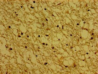 SYNPR Antibody