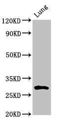 SYNPR antibody